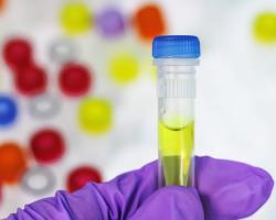 microbiologia alimentaria