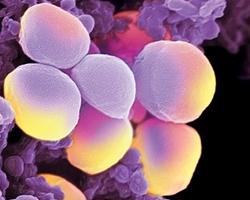 Staphylococcus aureus