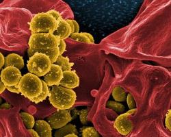 staphylococcus aureus